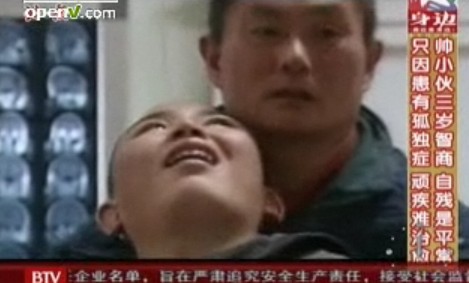 帅气男孩患孤独症经常自残